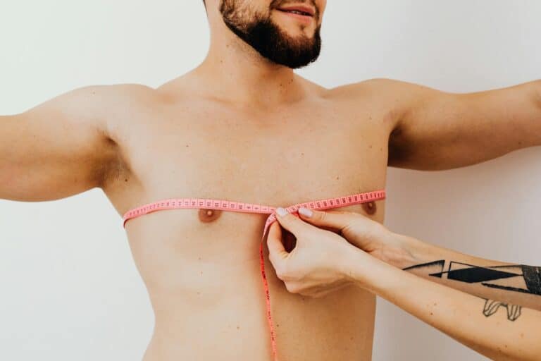 How Common Is Gynecomastia