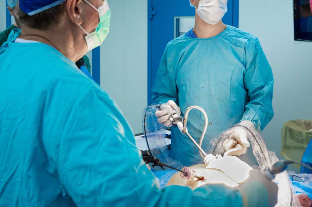 surgery the definitive solution
