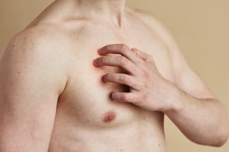 young man scratching his chest